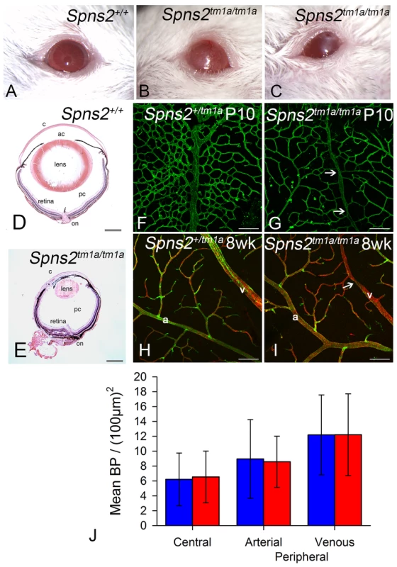 Eye defects in <i>Spns2<sup>tm1a/tm1a</sup></i> mice.