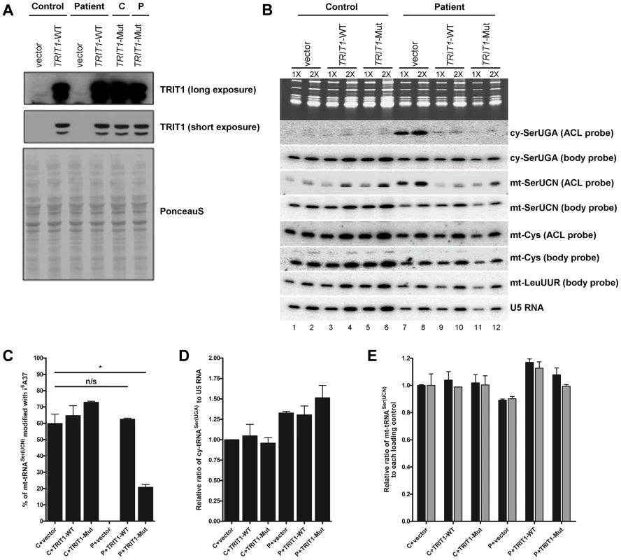 TRIT1 activity in patient fibroblasts is rescued by transduction with wild-type <i>TRIT1</i>.