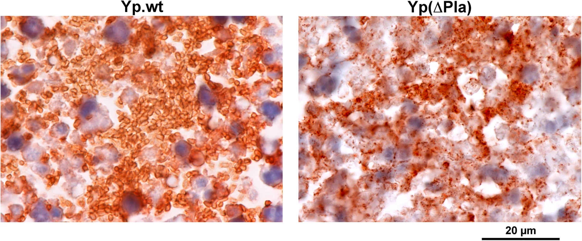 Impact of pPla on bacterial morphology in the dLN.