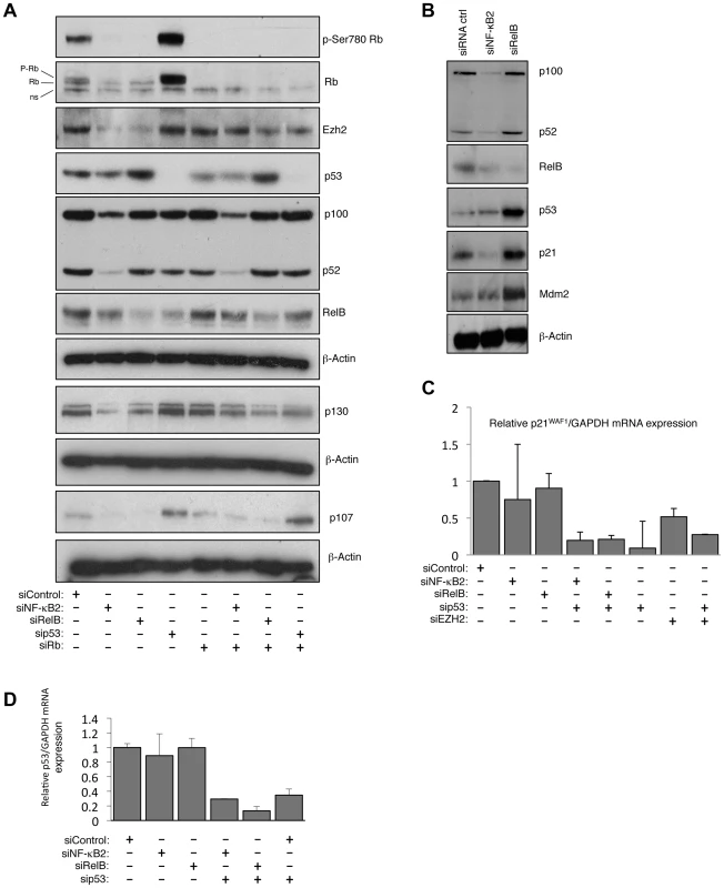 NF-κB2 and RelB regulate EZH2 in an Rb/E2F dependent manner.