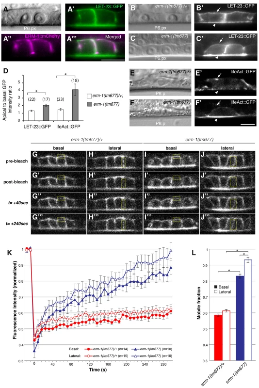 ERM-1 controls LET-23::GFP localization at the basolateral membrane of the vulval cells.