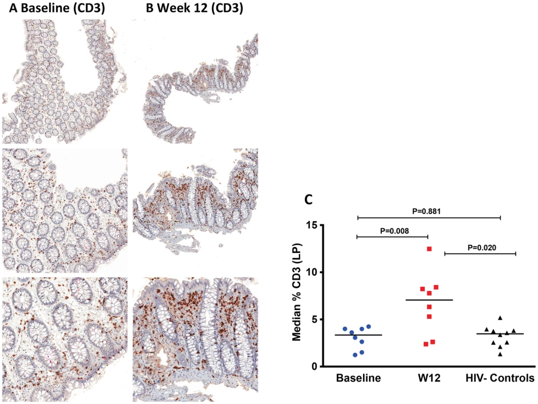 Increase of CD3<sup>+</sup> cells in the lamina propria (LP) by immunohistochemistry at week 12 after r-hIL-7 administration.