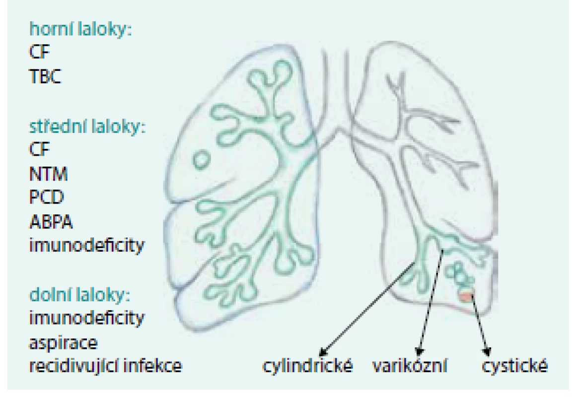 Predilekční místa výskytu BE u jednotlivých nemocí.