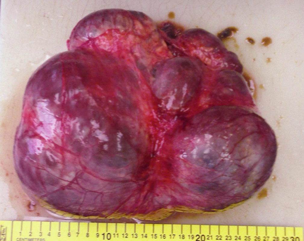 Preparát
Fig. 4. Histology sample