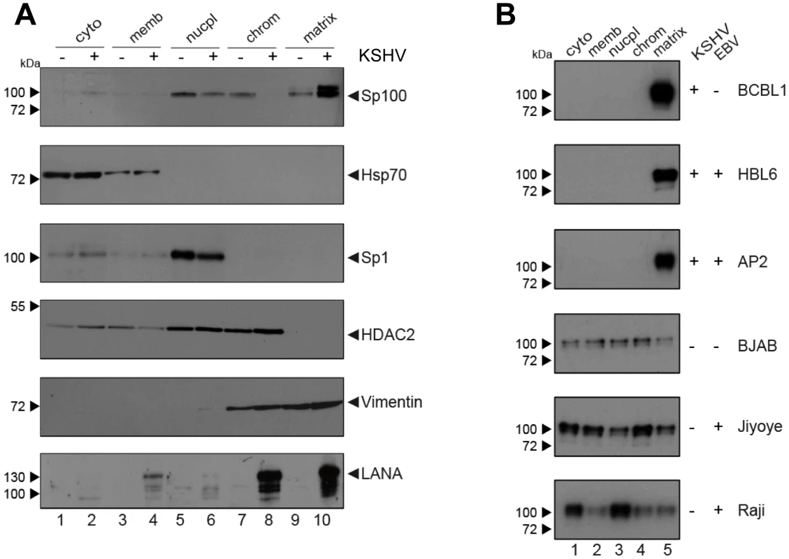 Sp100 accumulates in the insoluble matrix upon <i>de novo</i> infection and in PEL-derived B-cell lines.
