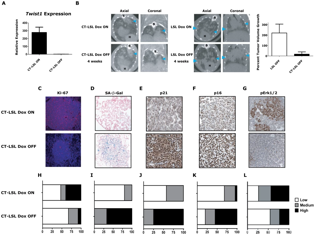 Activation of <i>Kras</i>-induced senescence by down-regulation of <i>Twist1</i> in autochthonous <i>Kras<sup>G12D</sup></i>/<i>Twist1</i>-induced lung tumors.