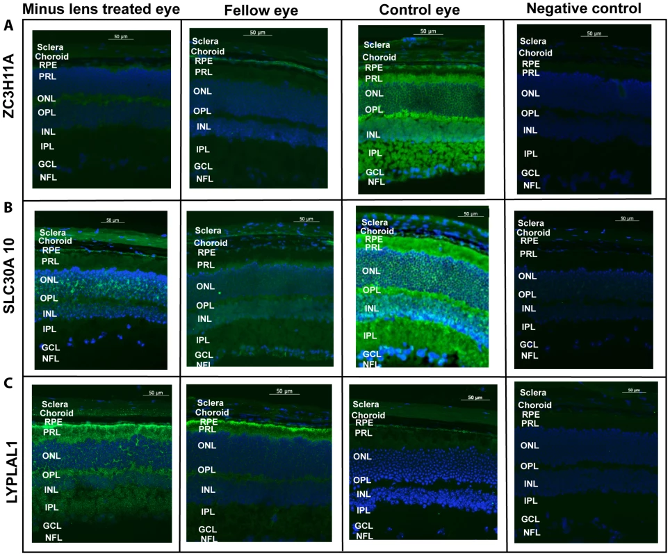 Immunofluorescent labeling.