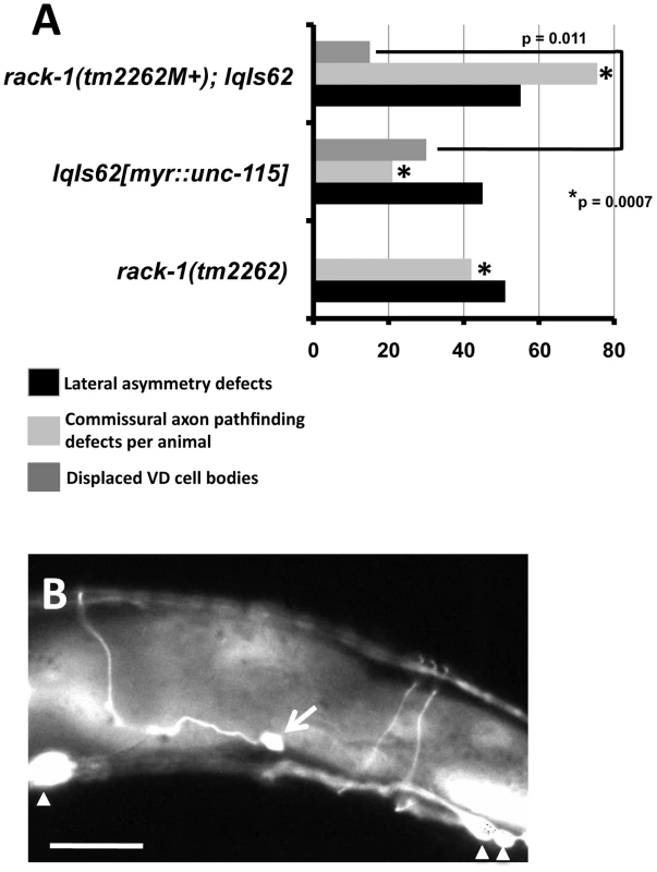 Activated MYR::UNC-115 in VD/DD motor neurons is not suppressed by <i>rack-1(tm2262)</i>.