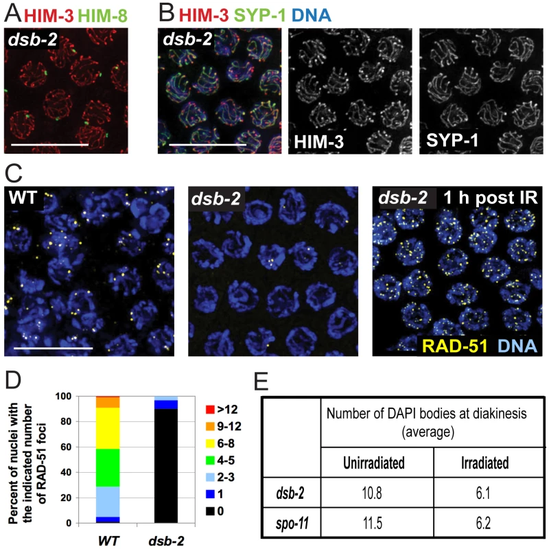 DSB-2 is required for meiotic DSB formation.
