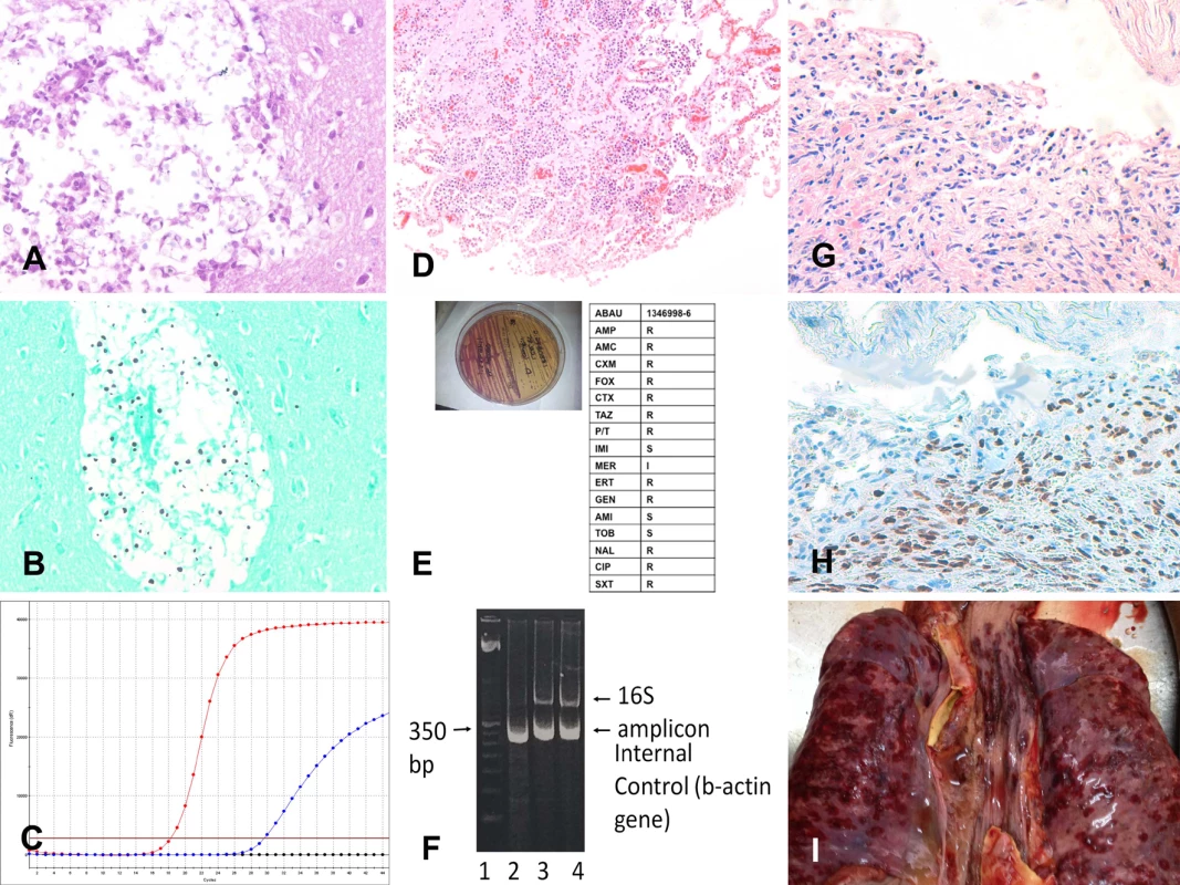 Three representative cases of cause of death identification by minimally invasive autopsy.