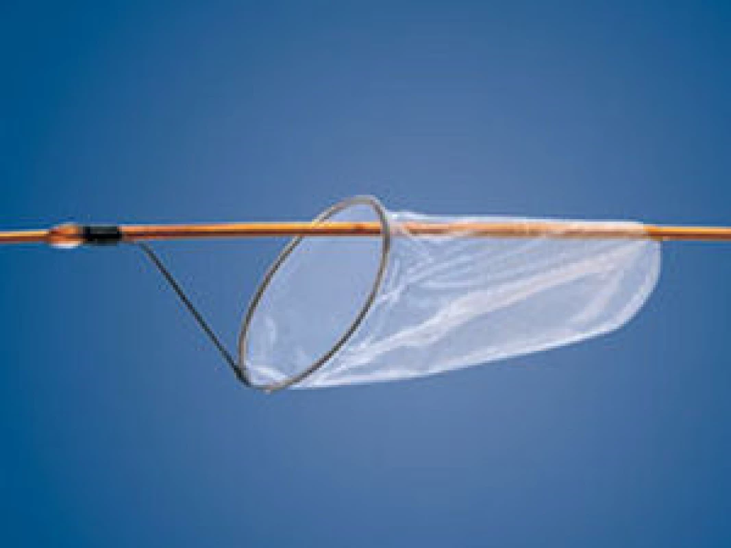 Distální protekce (filtr), polopropustný košíčeks póry 110 μm (FilterWire EZ, Boston Scientific)