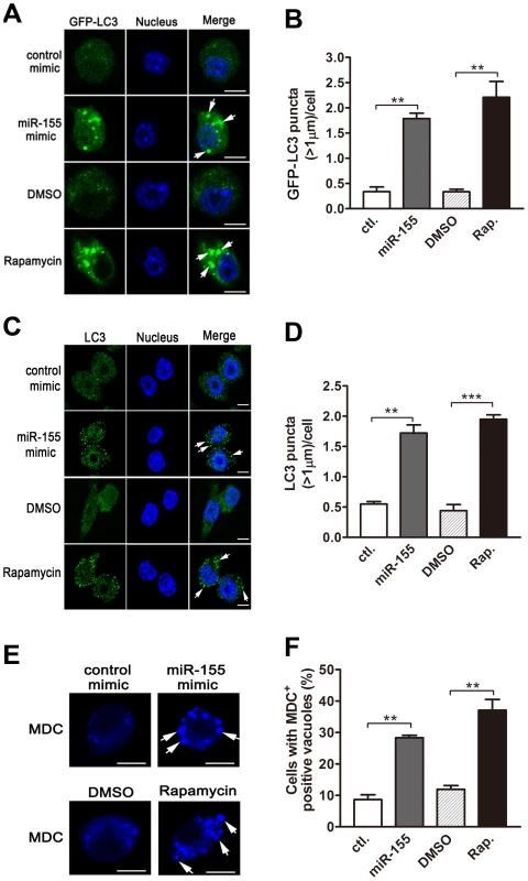 miR-155 promotes autophagosome formation.