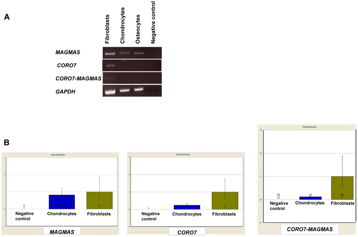 Transcript expression analysis of <i>MAGMAS</i>, <i>CORO7</i> and <i>CORO7-MAGMAS</i>.