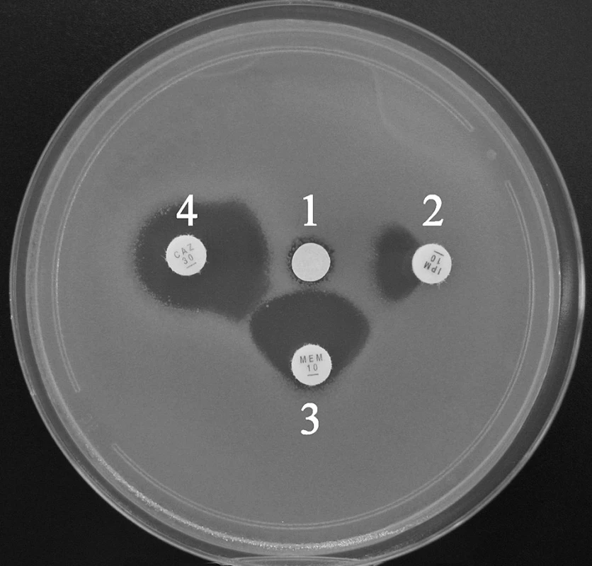 Průkaz metalo-β-laktamáz pomocí SDT s inhibicí EDTA. Synergie je patrná mezi všemi indikátorovými β-laktamy a inhibitorem (1 – disk s EDTA, 2 – imipenem, 3 – meropenem, 4 – ceftazidim)
Fig. 1. Synergy disk test with EDTA for metallo-β-lactamase detection. Synergy can be observed between inhibitor and all β-lactams (1 – disk with EDTA, 2 – imipenem, 3 – meropenem, 4 – ceftazidime)
