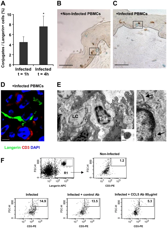 HIV-1-infected cells increase the formation of epidermal LC-T-cell conjugates.