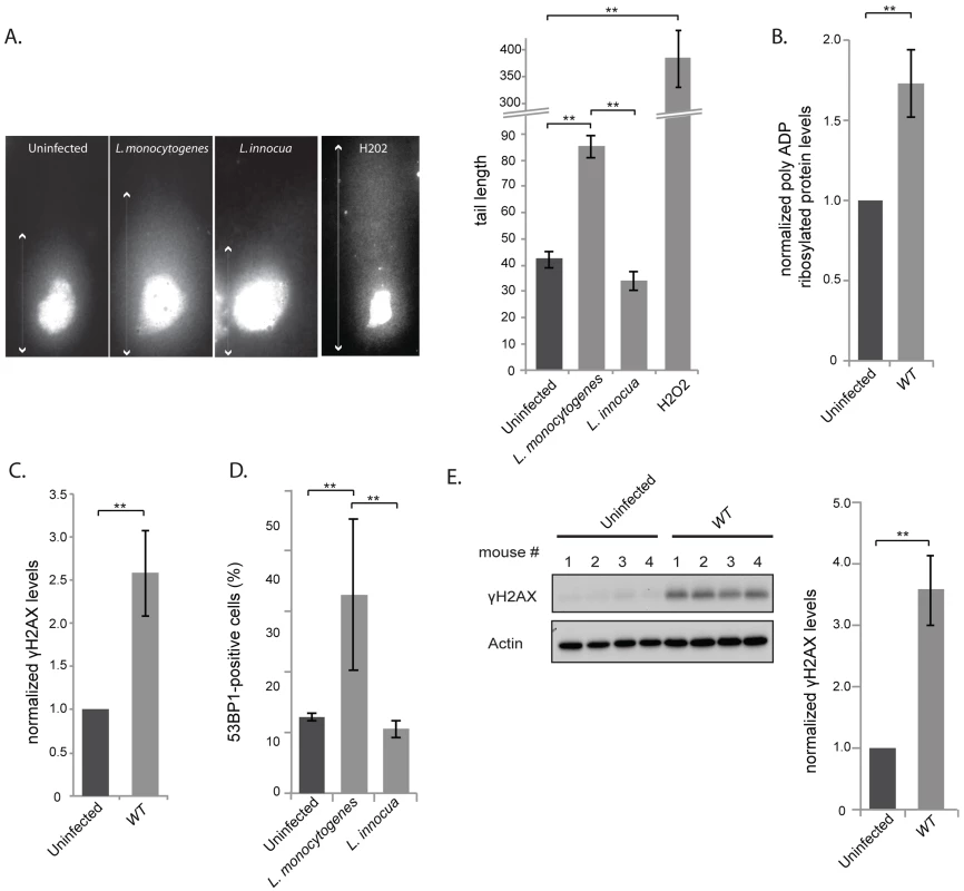 <i>L. monocytogenes</i> induces DNA breaks and mildly activates the DNA damage response.