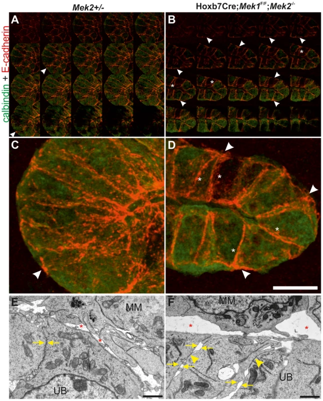 MAPK pathway activity is required for normal E-cadherin localization and epithelial cell adhesion.