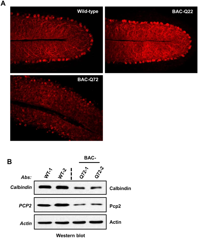 PC morphology in BAC-Q22 and BAC-Q72 mice.