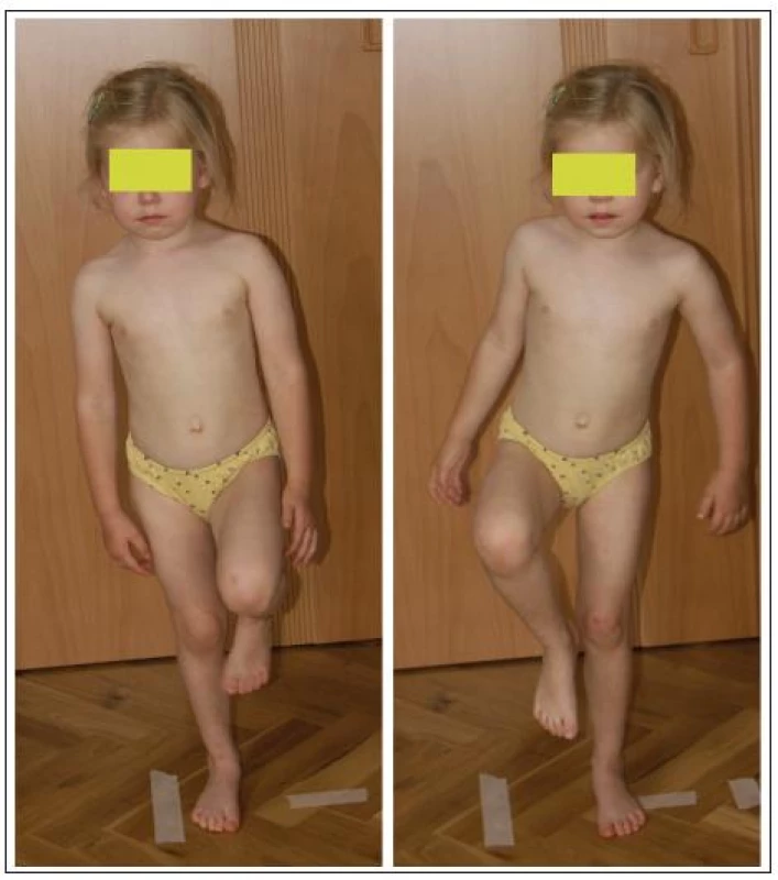 Stoj na jedné končetině ve věku 42 měsíců.