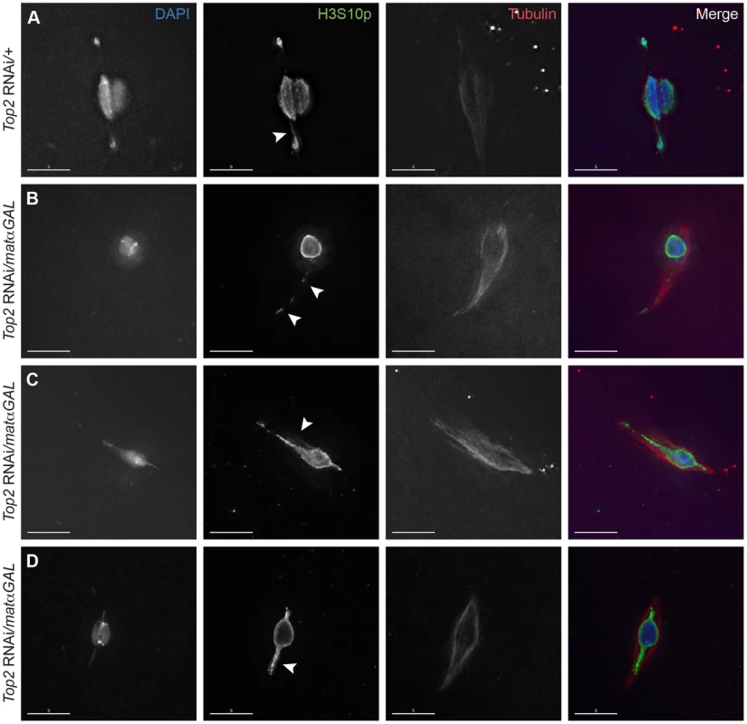 Expression of a <i>Top2</i> RNAi construct in the ovary leads to abnormal chromosomal projections during meiosis I.