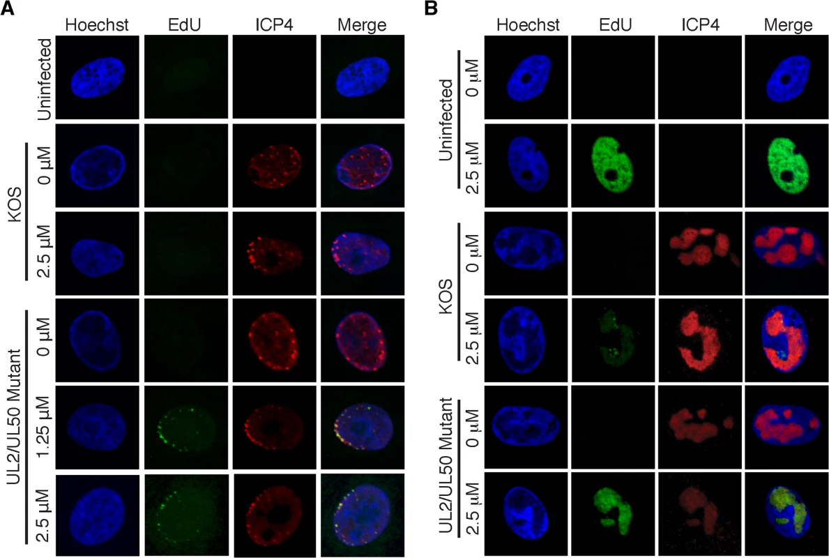Visualization of EdU labeled HSV-1 genomes.