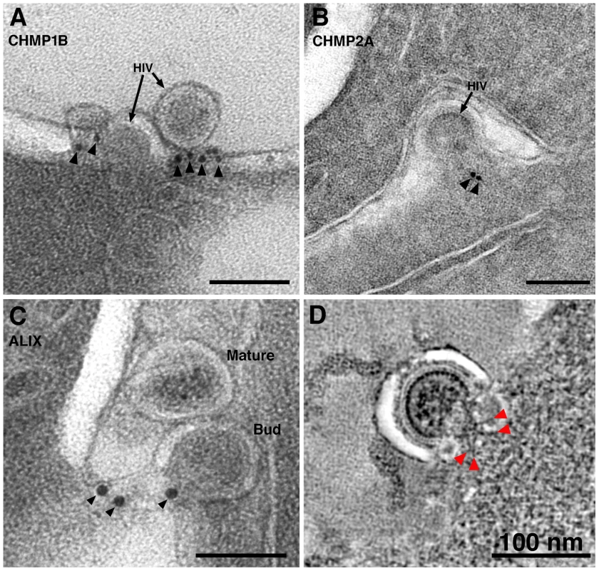ImmunoEM of ESCRT pathway proteins at sites of HIV-1 budding in GALT.