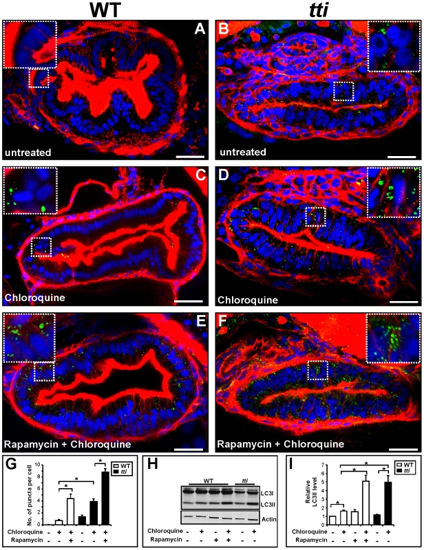 Comparable autophagic flux in the IECs of <i>tti<sup>s450</sup></i> larvae and WT larvae treated with rapamycin.