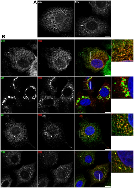 Subcellular localization of NS2.