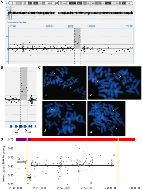 Identification of an X specific insertional translocation in Y.