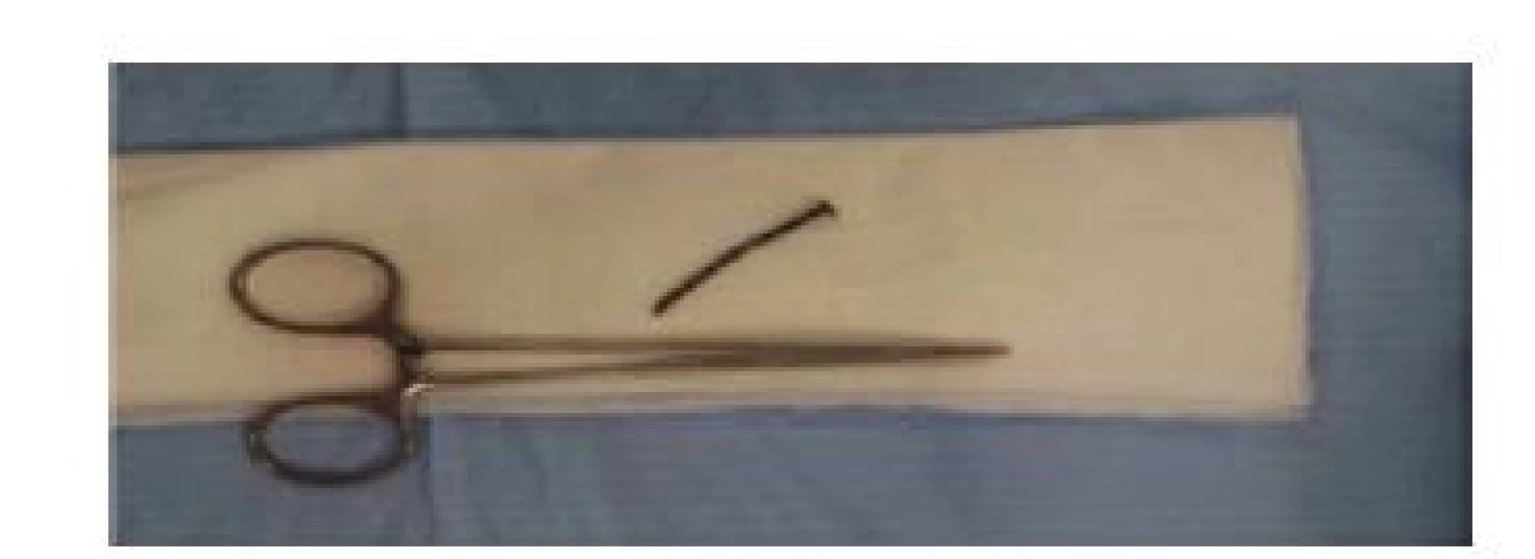 Extrahovaný hřebík o velikosti 5 cm<br>
Fig. 4. The removed nail with a length of 5 cm