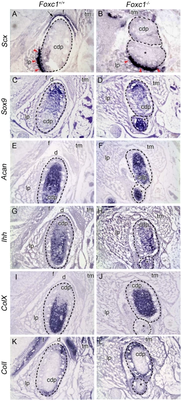 Molecular analysis of developing TMJ in <i>Foxc1<sup>−/−</sup></i> embryos.