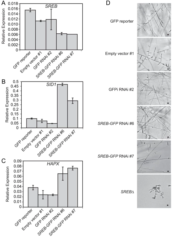 Silencing of <i>SREB</i> using RNA interference.