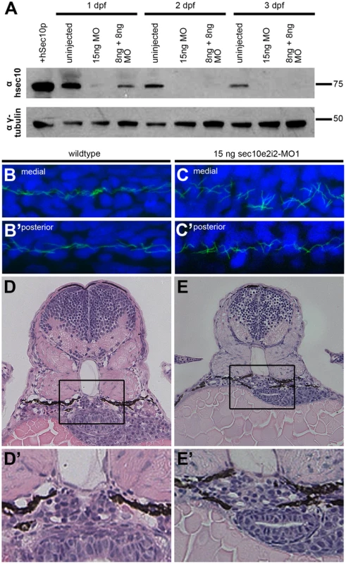 sec10MO embryos show abnormal pronephric development.