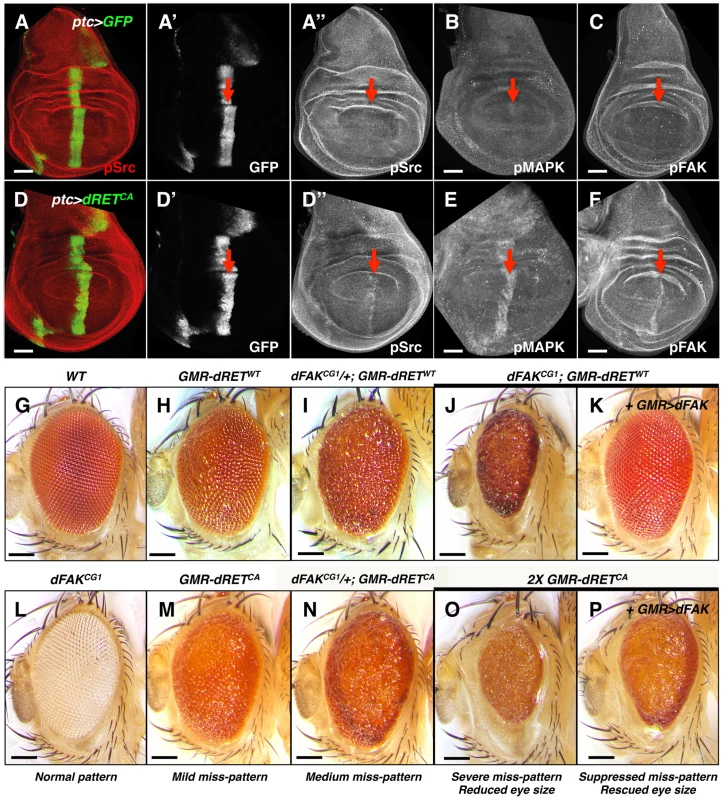 Genetic interactions between RET and FAK.