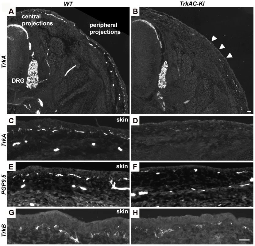 Peripheral innervation defect is evident during embryonic development.