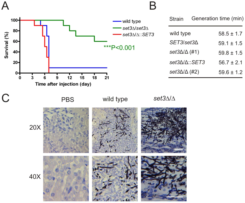 The <i>set3</i>Δ/Δ mutant shows attenuated virulence in a murine infection model.