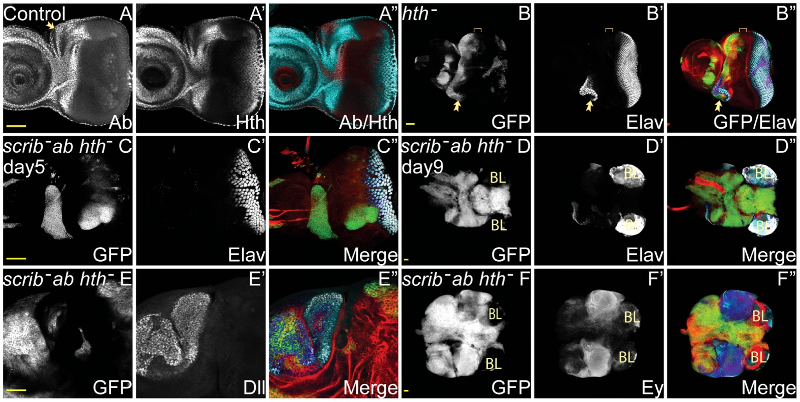 Hth is not essential for <i>scrib</i><sup>−</sup>+<i>ab</i> tumour overgrowth.