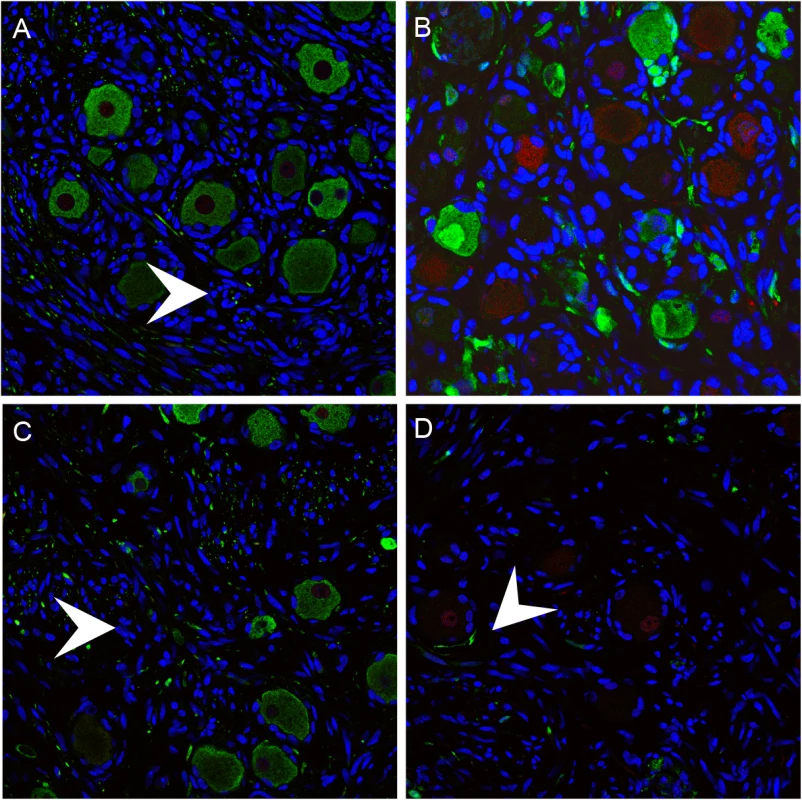 Mechanoreceptive neurons are selectively depleted after the acute phase of DRG infection and SGC infection contributes to VZV-induced neuronal cell loss and ganglionic damage.