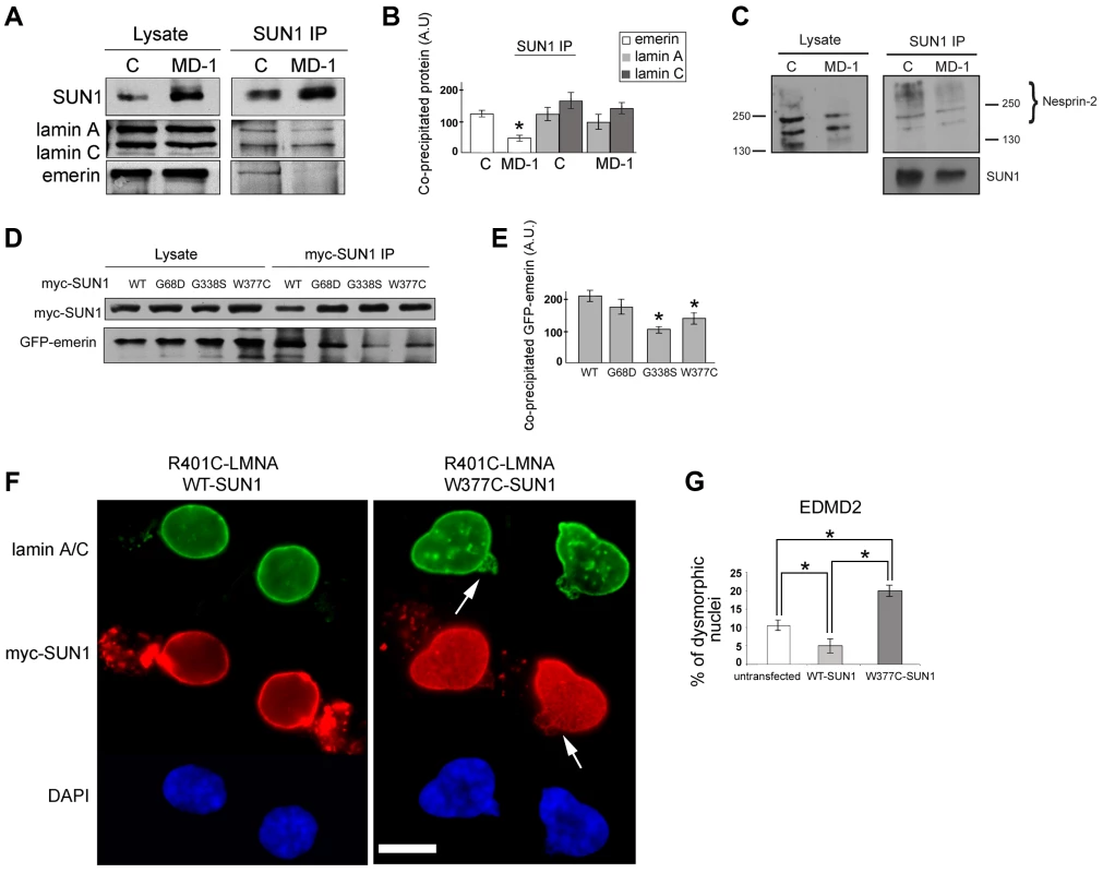 Emerin binding to p.G68D/p.G338S SUN1 is reduced <i>in vivo</i>.