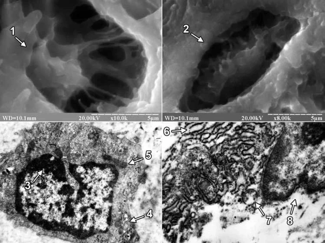 Tibial regenerate cells on the 24th day after the injury.