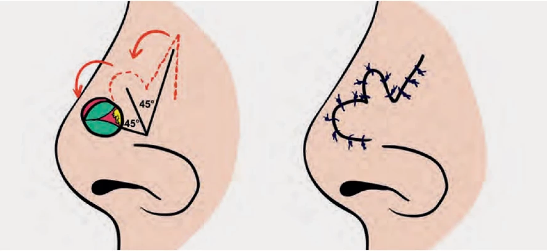 Fig. 3.