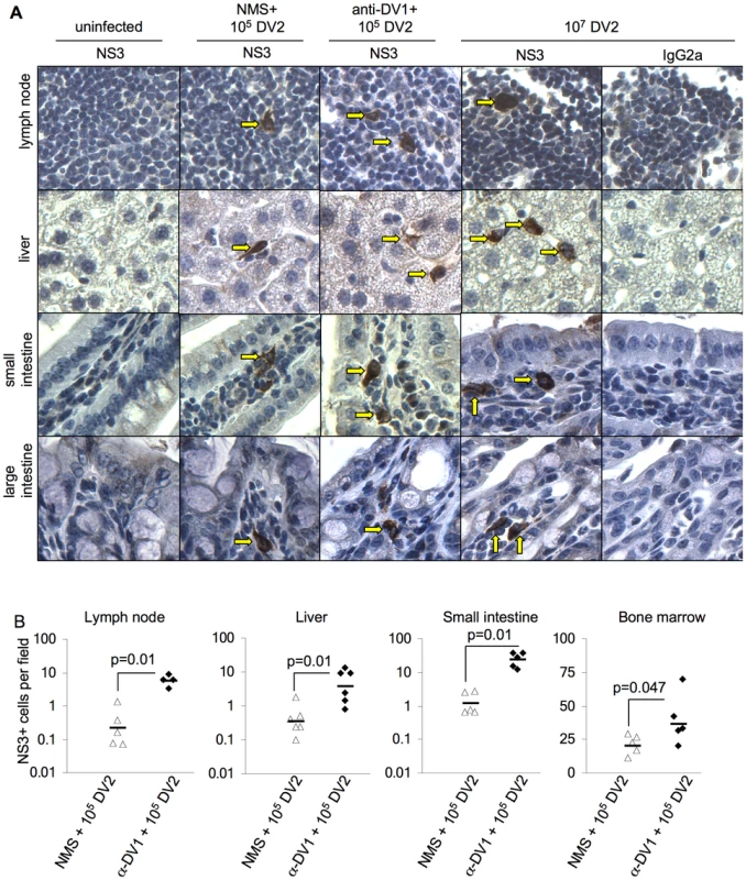 Detection and quantification of DV-infected cells with or without antibody-dependent enhancement.