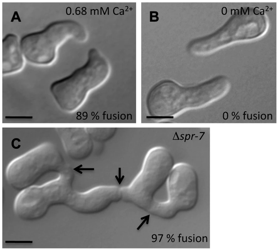 Conidial germling fusion phenotypes.