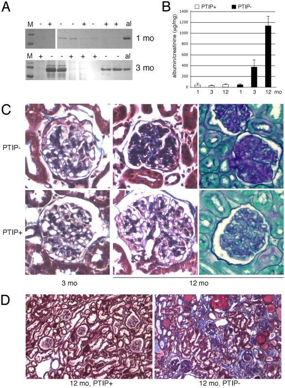 Chronic Glomerular Disease in PTIP− Kidneys.