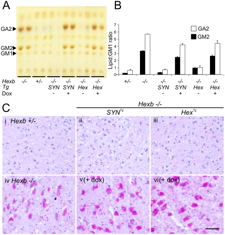 Doxycycline mediated silencing of transgenic <i>Hexb</i> expression induces storage of glycolipids.