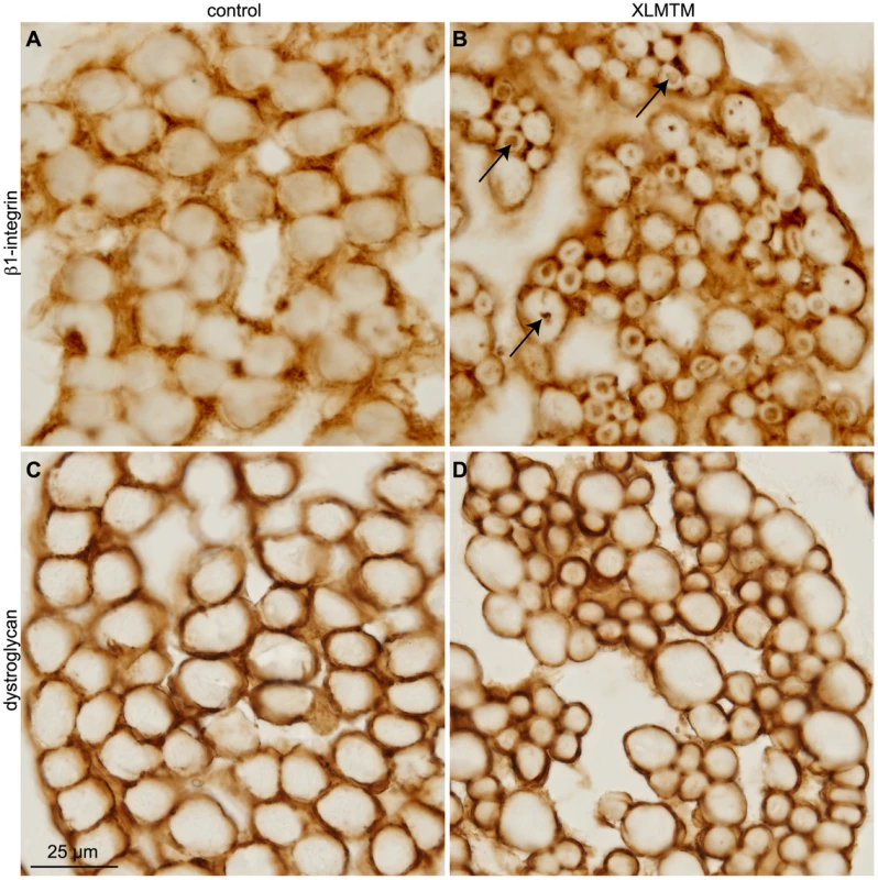 β1-integrin is mislocalized to perinuclear inclusions in XLMTM myopathy.