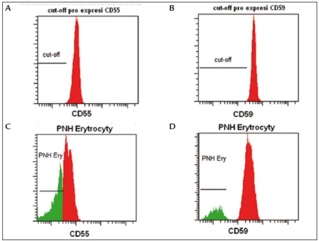 Fluorescenční standardy slouží k nastavení cut-off, podle kterého odlišujeme normální erytrocyty (oblast nad prahem) od PNH erytrocytů (oblast pod prahem).