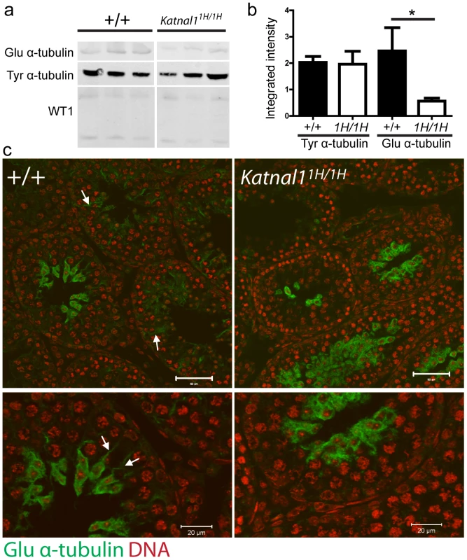Loss of KATNAL1 function leads to reduced numbers of stable microtubules in SCs.