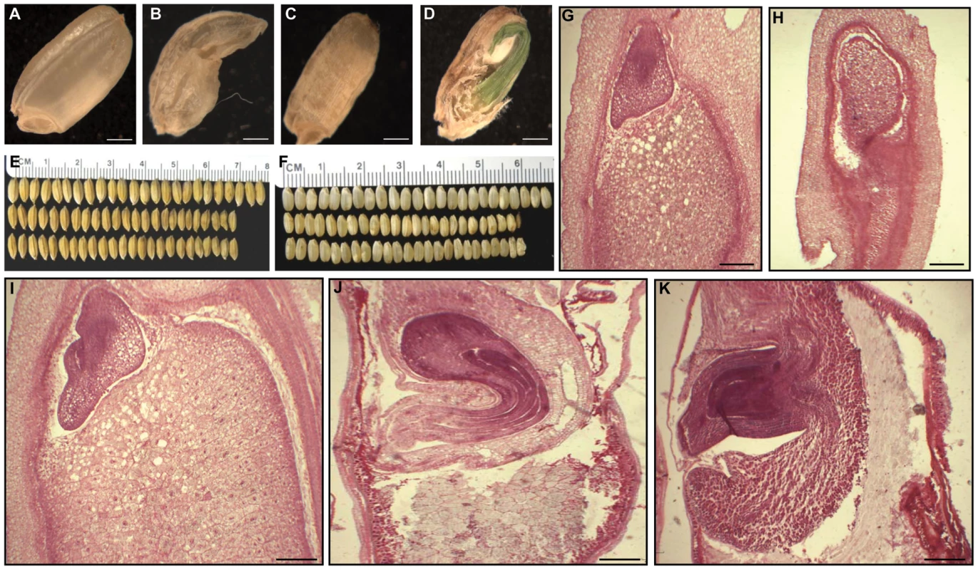 Phenotypes of <i>OsFIE2</i>-RNAi seeds.
