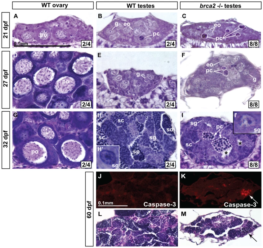 Developing gonads of <i>brca2</i> mutants lack perinucleolar oocytes and develop testes that contain pyknotic and apoptotic cells.